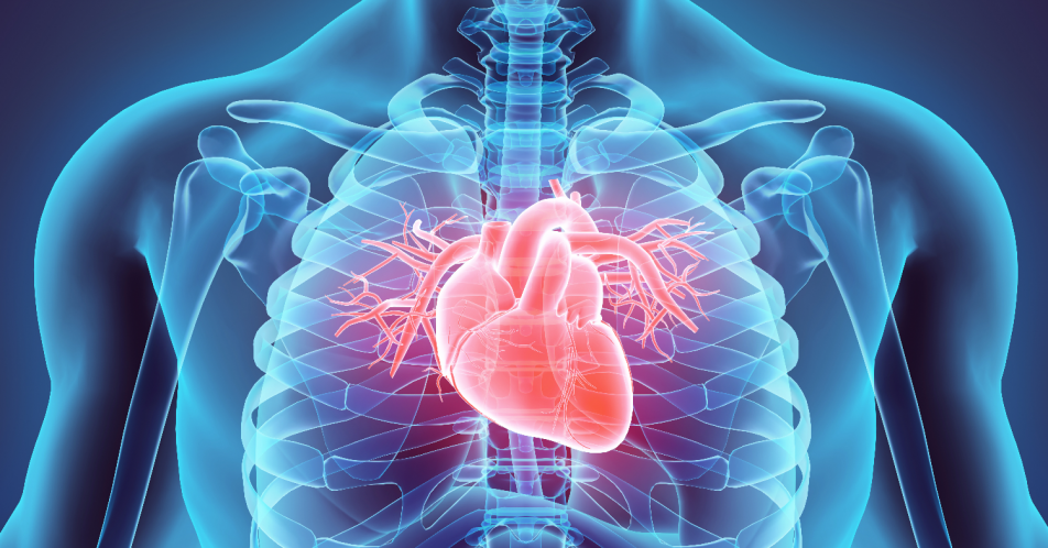 Transthyretin-Amyloidose mit Kardiomyopathie: Fehldiagnose Herzinsuffizienz